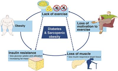 Diabetes and Sarcopenic Obesity: Pathogenesis, Diagnosis, and Treatments